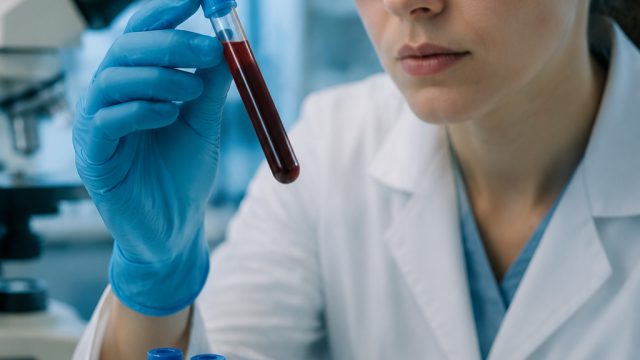 Revolutionary Blood Test for Cancer Detection on the Horizon